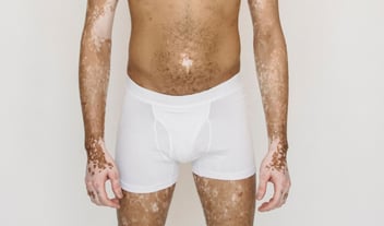 A trans person with vitiligo confidently posing in boxers