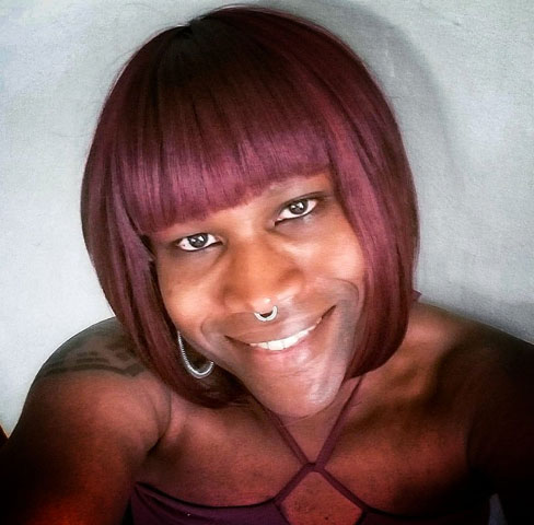 Danielle, an Electrolysis recipient