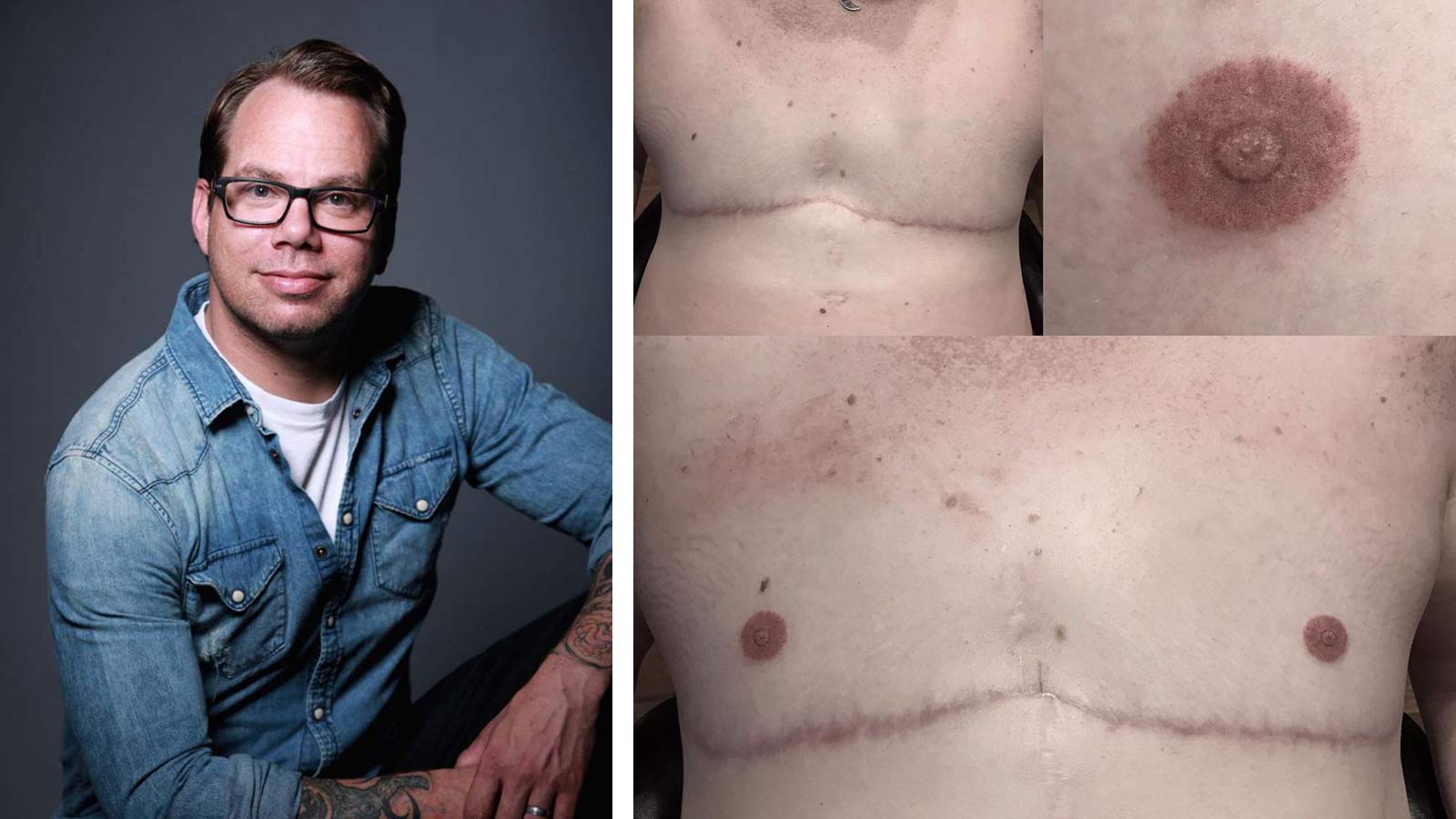 kylie on Twitter saw this trans man on tiktok get a tattoo of his top  surgery scars so they would never fade and cis people were so confused  because they didnt understand